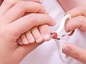 美国哪些人不能做皮肌炎试管婴儿？