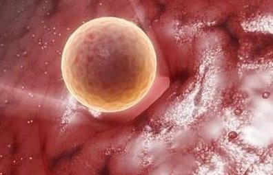 试管婴儿可以排除遗传病基因吗？试管婴儿可以排除基因缺陷吗？